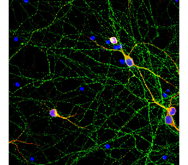 Customer feedback Image IR41-124 anti-Phospho-Tau (Thr181) antibody IF image