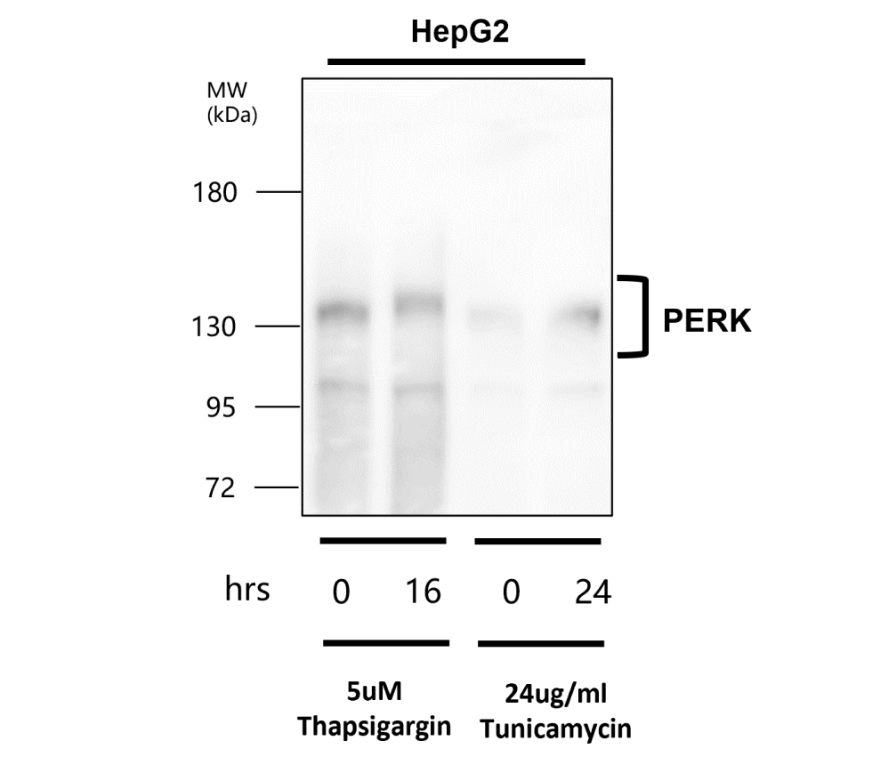 IR135-538 anti-PERK antibody WB image