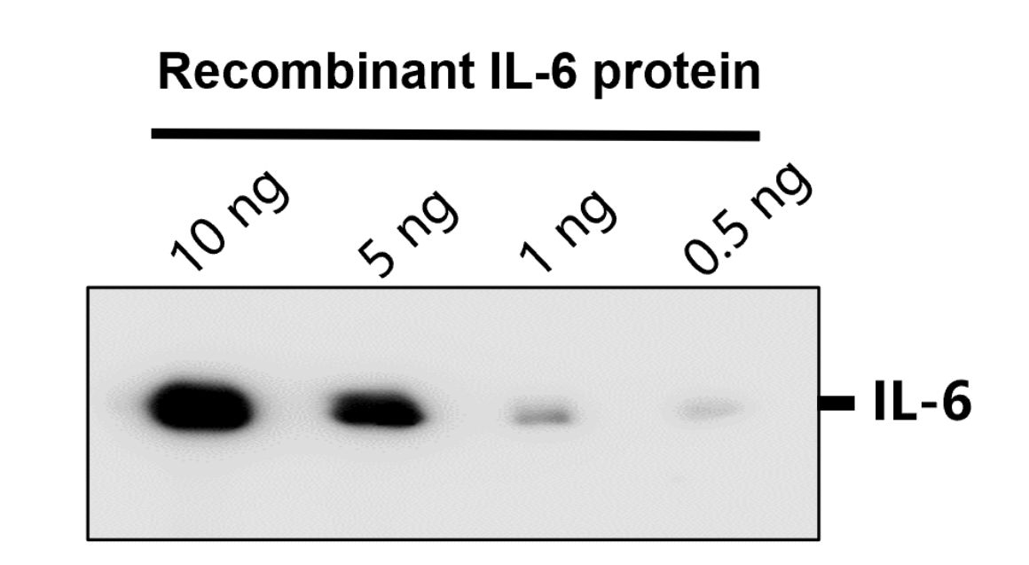 IR74-P1 anti-IL6 antibody WB image