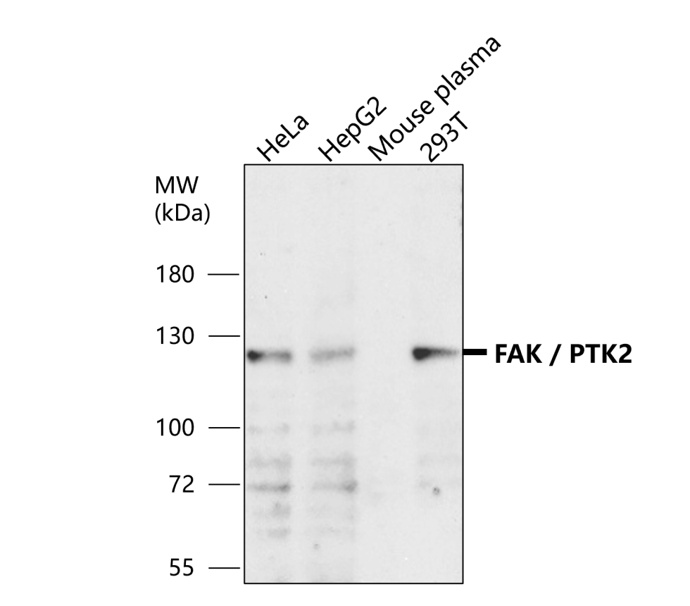 IR58-200 anti-FAK / PTK2 antibody WB image