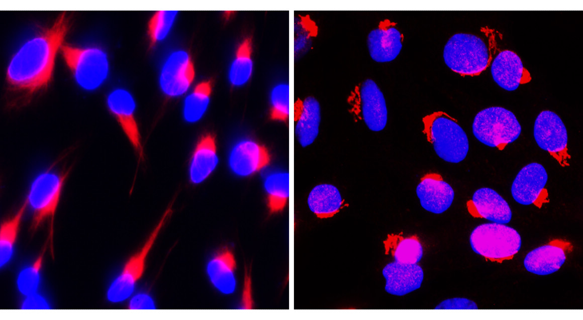 IR48-147 anti-Fibronectin antibody ICC/IF image