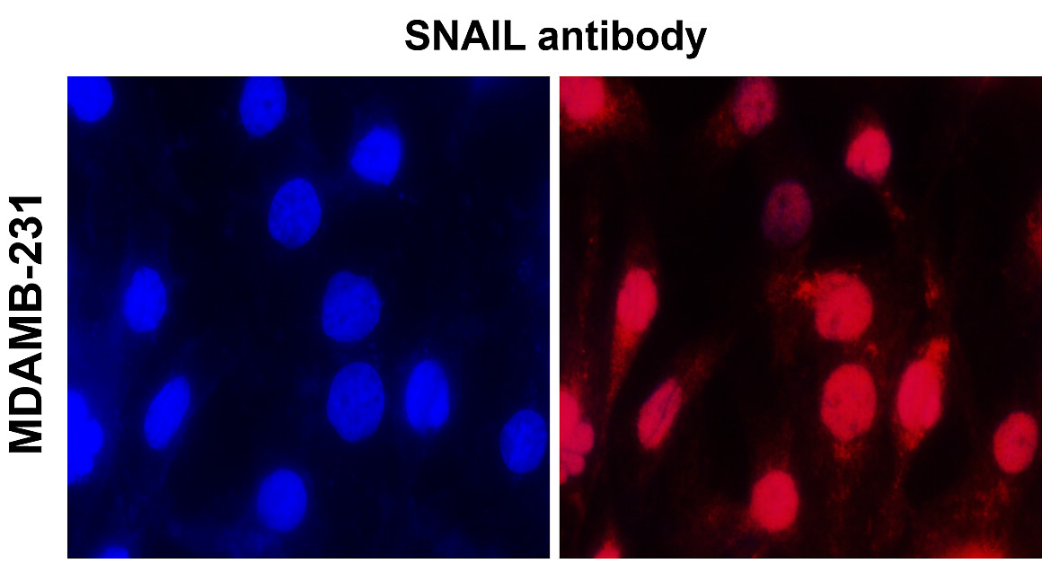 IR50-154 anti-SNAIL antibody ICC/IF image