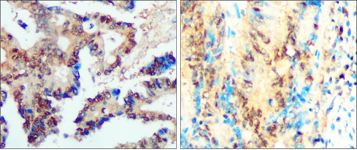 IR50-154 anti-SNAIL antibody IHC image