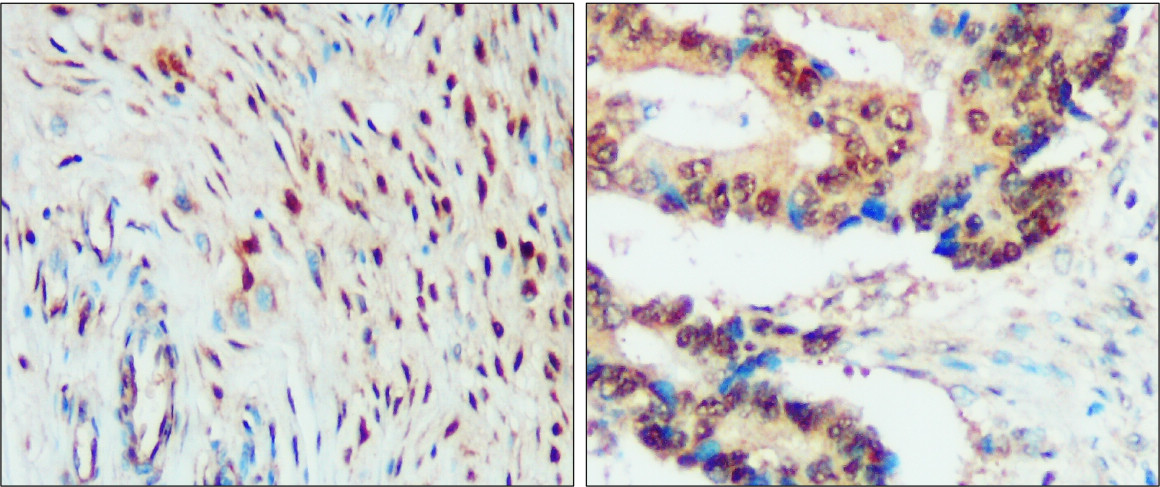 IR50-154 anti-SNAIL antibody IHC image