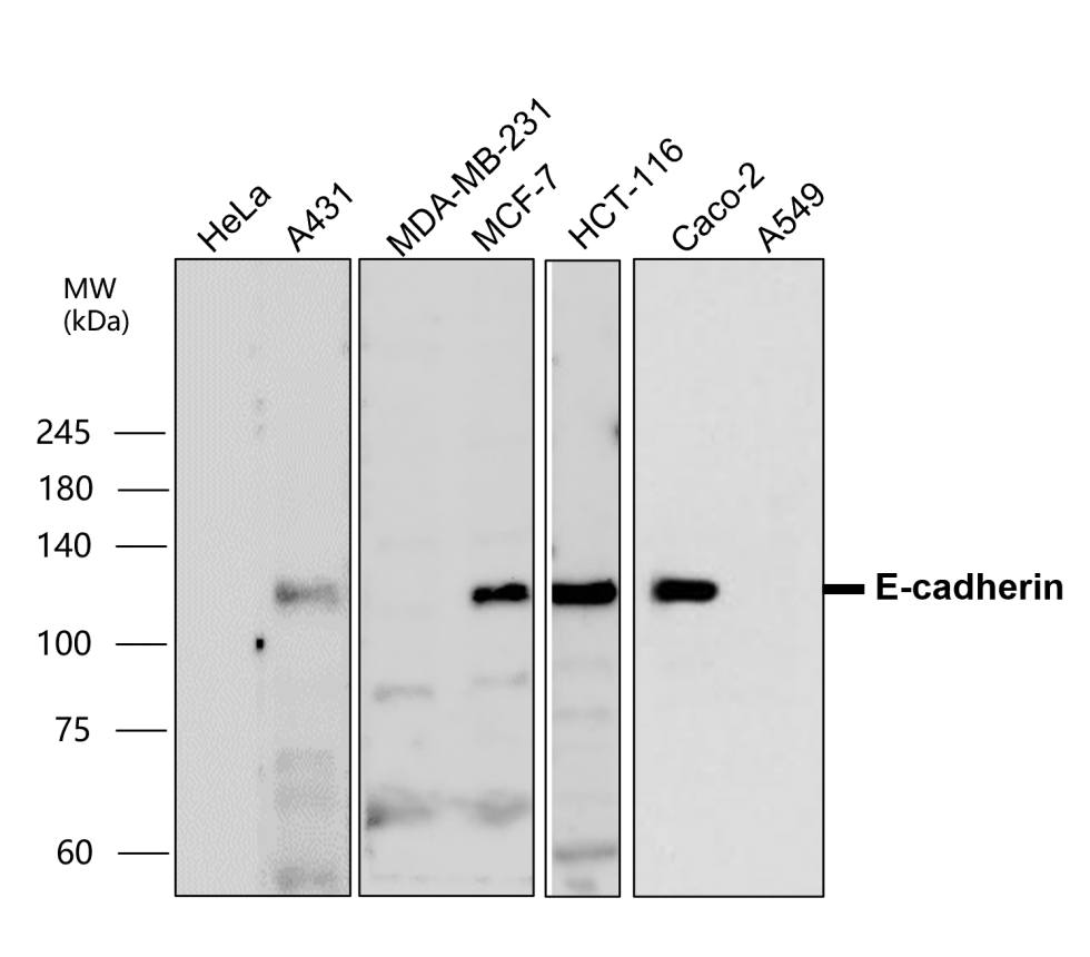 E Cadherin Antibody Extracellular Domain Ir Ireal Biotechnology Inc