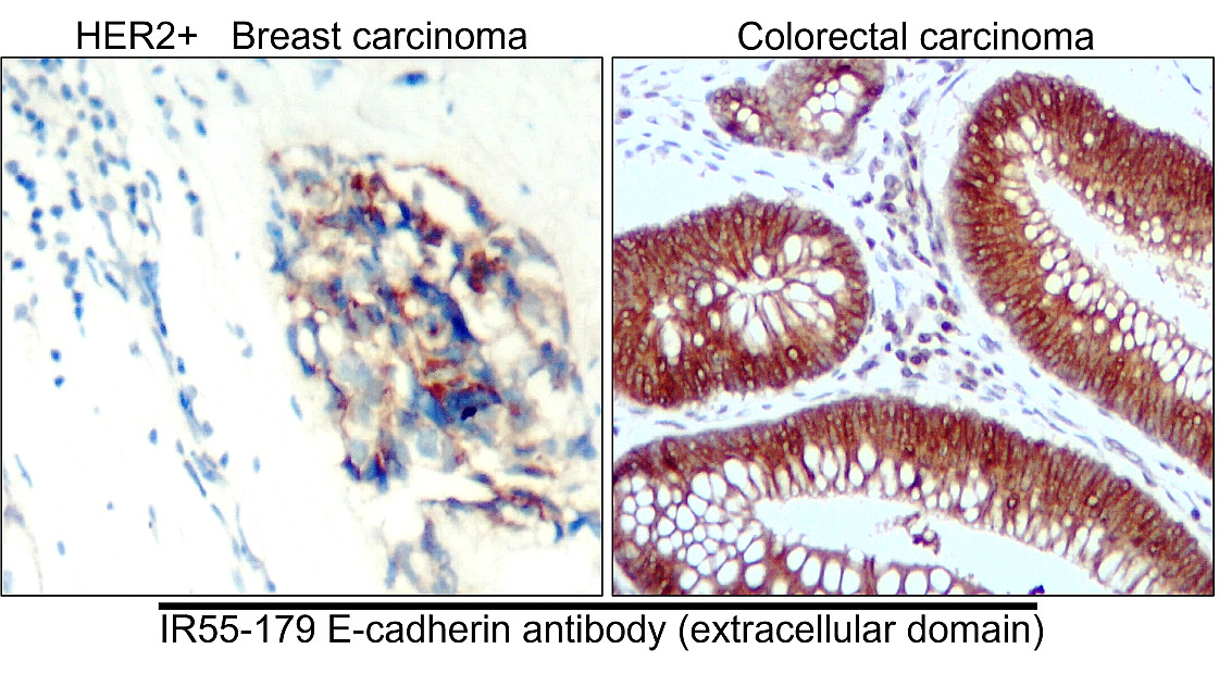 IR55-179 anti-E cadherin antibody IHC image