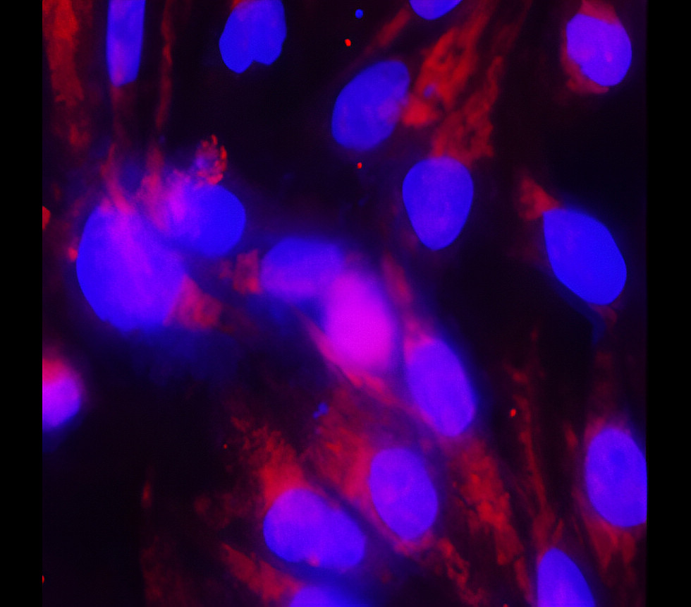 IR57-193 anti-Occludin antibody ICC/IF image