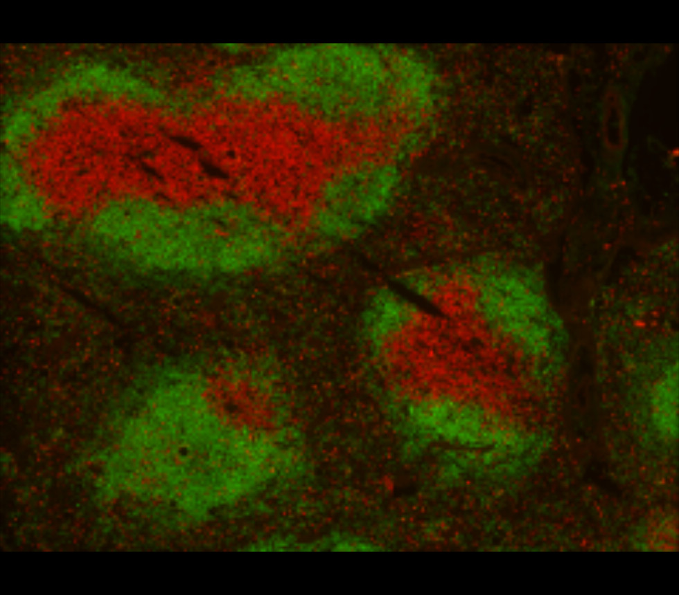 Customer feedback IRR001 anti-CD3 antibody IHC-Fr image