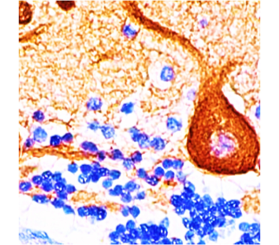 IRM008 anti-Tuj1 monoclonal antibody IHC image