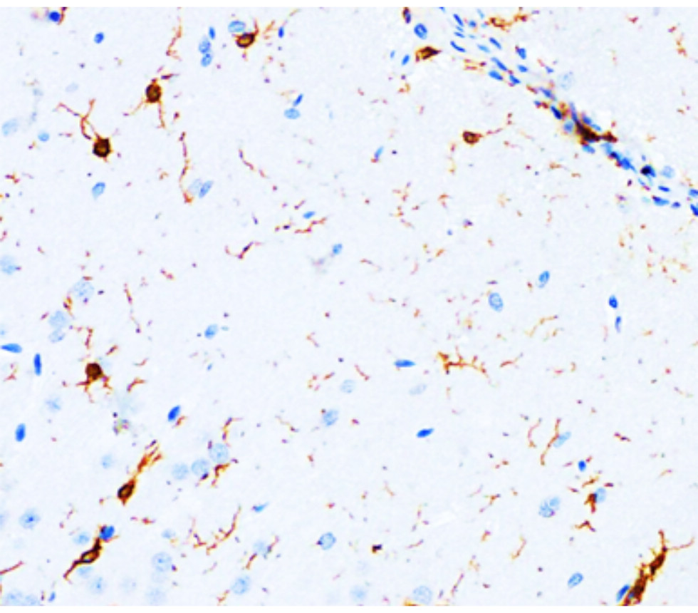 IRM007 anti-Iba1 monoclonal antibody IHC image