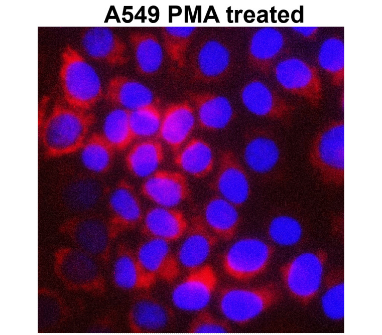 IR66-225 anti-MMP1 antibody_A549 PMA treated ICC image