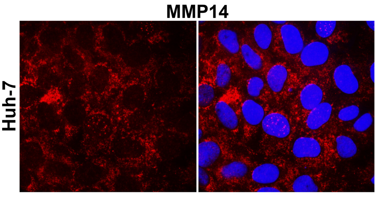 IR71-245 anti- MMP14 / MT1-MMP antibody_Huh-7 ICC/IF image