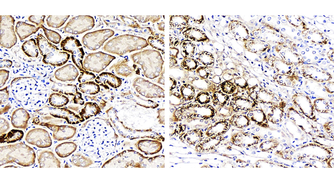 Customer feedback IRCP011 anti FNDC5 / irisin antibody IHC image