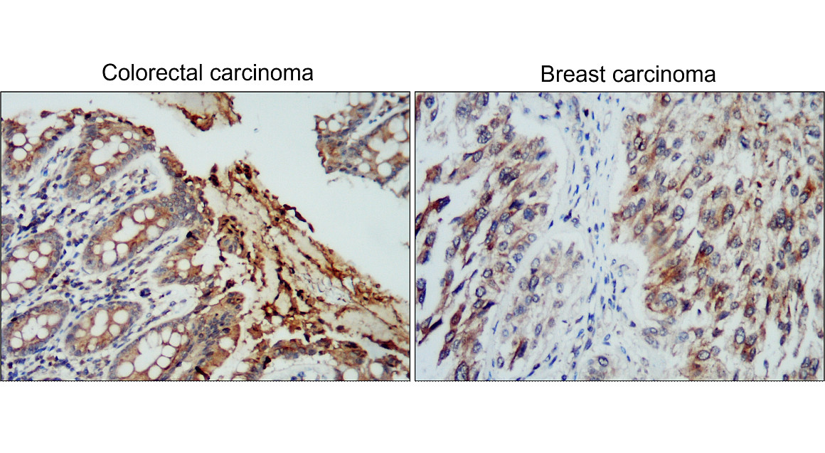 IR72-249 anti-TIMP1 antibody IHC image