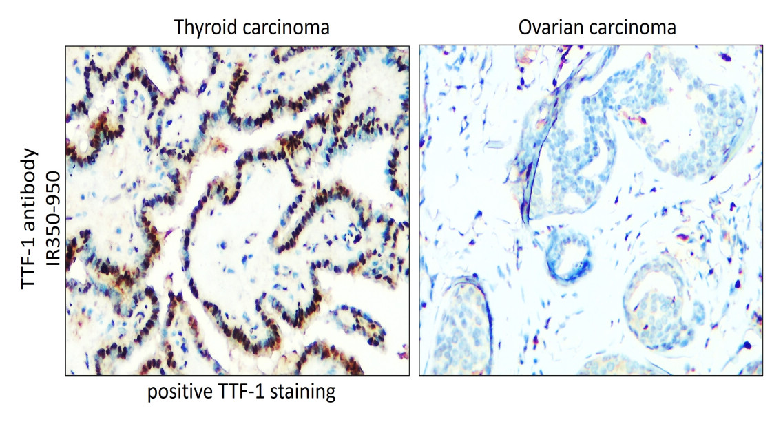 IR350-950 anti-Thyroid Transcription Factor 1 antibody IHC image