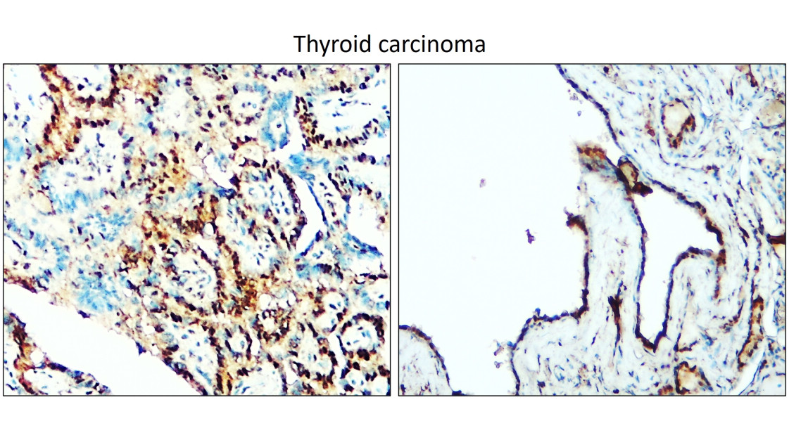 IR350-950 anti-Thyroid Transcription Factor 1 antibody IHC image