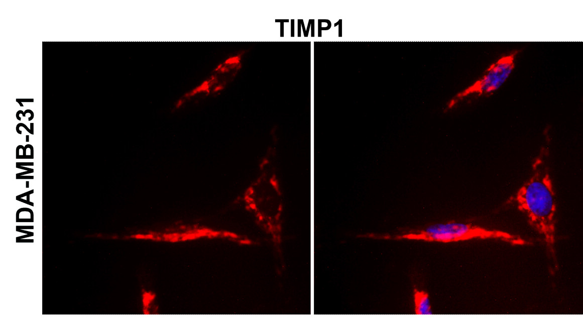 IR72-249 anti-TIMP1 antibody_MDA-MB-231 ICC/IF image