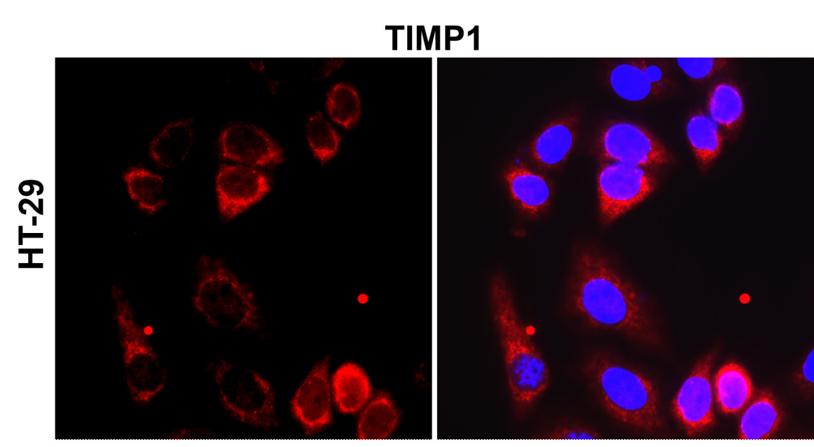 IR72-249 anti-TIMP1 antibody_HT-29 ICC/IF image