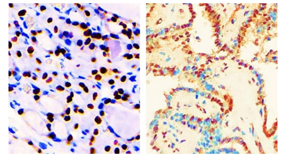 IR350-950 anti-Thyroid Transcription Factor 1  antibody IHC image