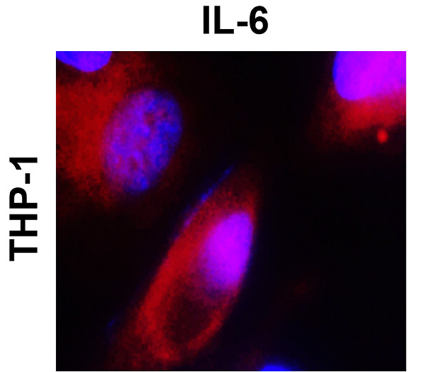 IR74-P1 anti-IL6 antibody ICC/IF image