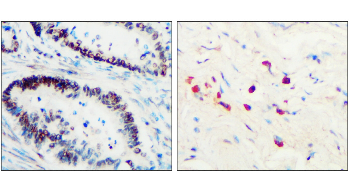 IR323-1016 anti- Toll-like Receptor 3 antibody IHC image