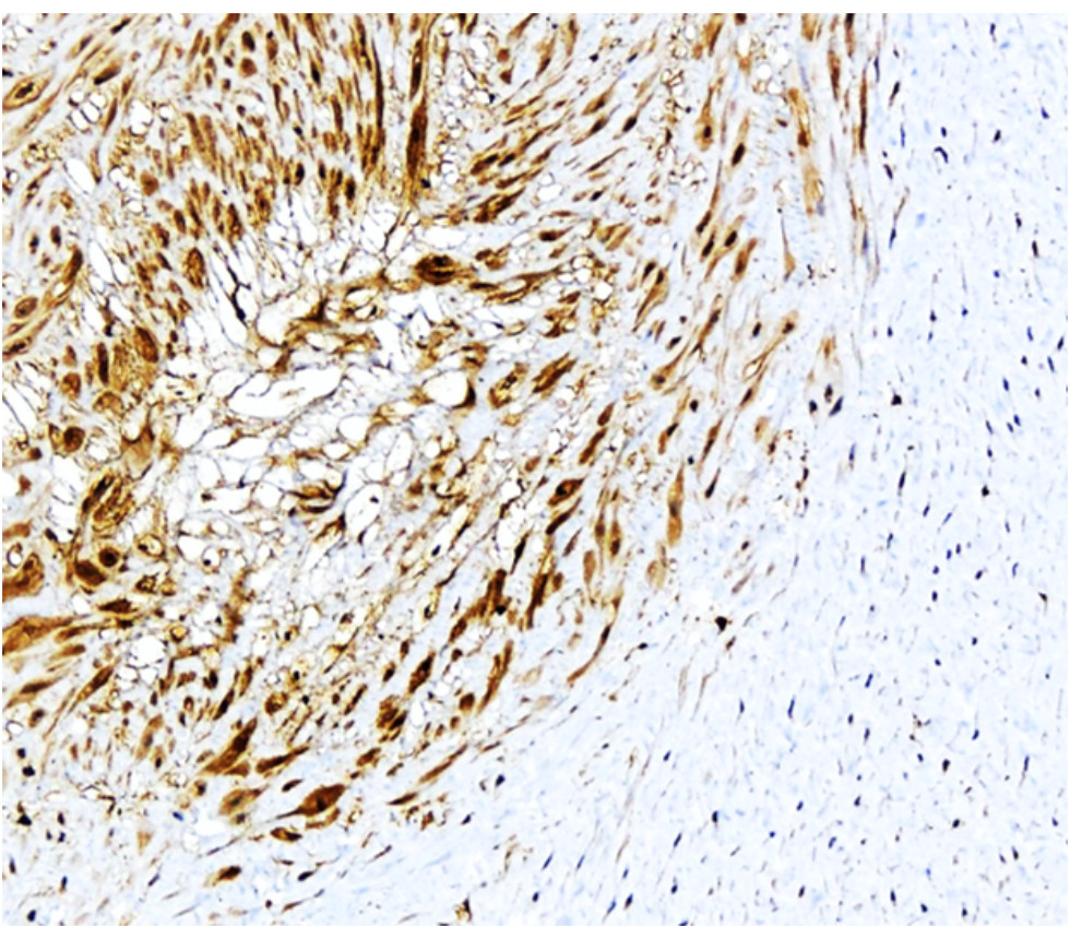 IR307-912 anti P-selectin / CD62P antibody IHC image