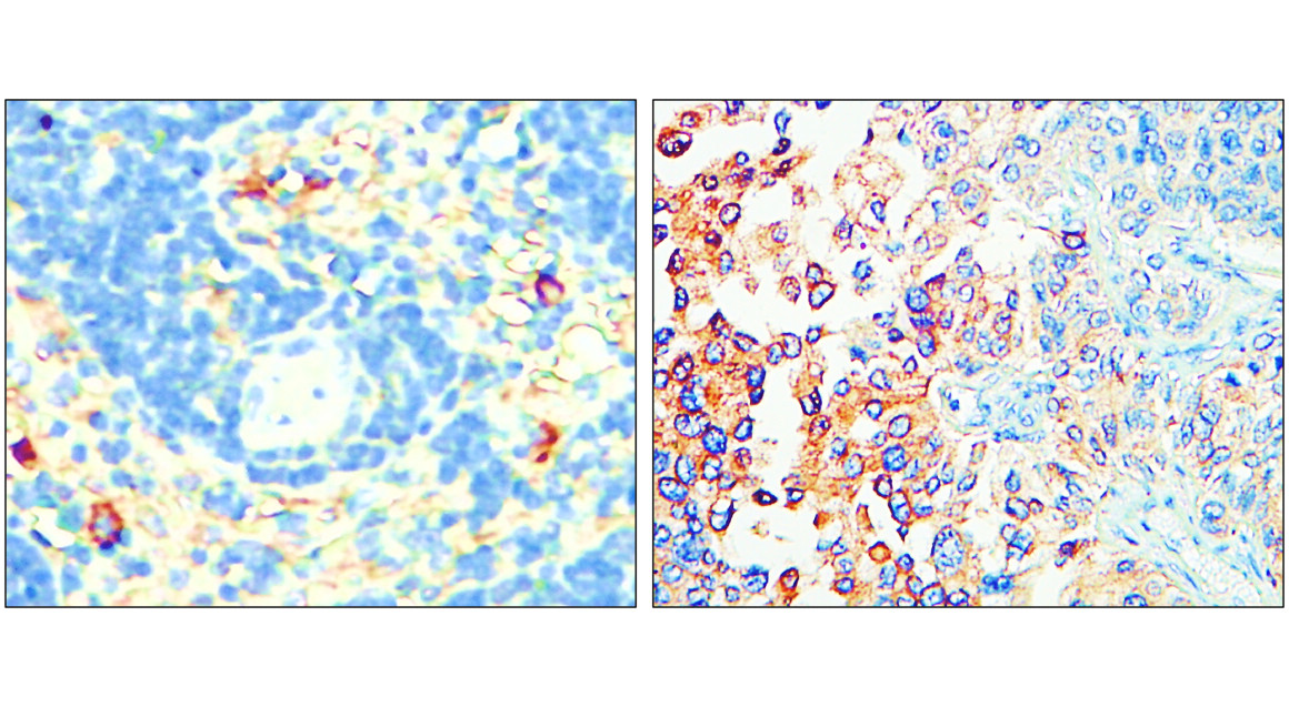 IR307-912 anti P-selectin / CD62P antibody IHC image