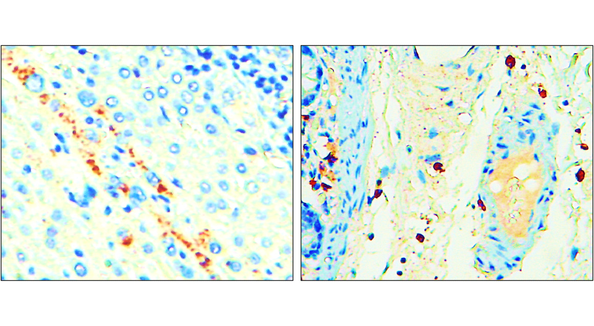 IR307-912 anti P-selectin / CD62P antibody IHC image