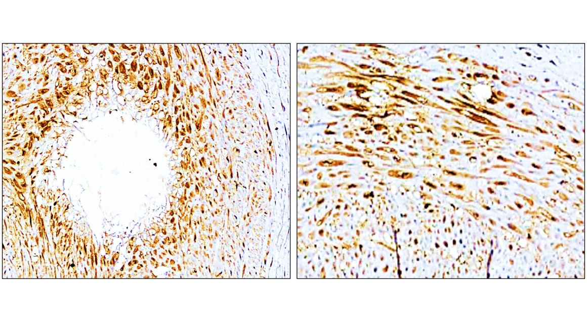 IR307-912 anti P-selectin / CD62P antibody IHC image