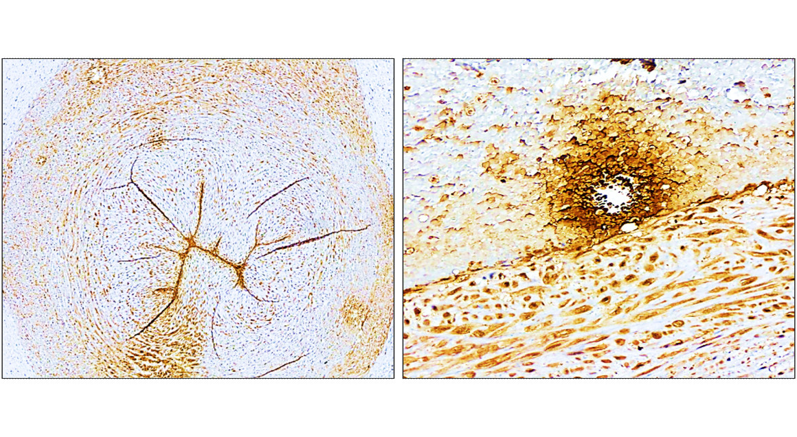 IR307-912 anti P-selectin / CD62P antibody IHC image