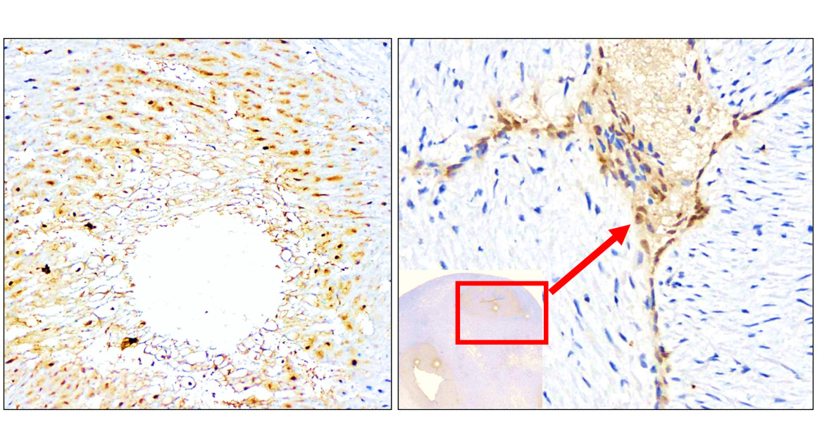 IR306-909 anti L-selectin / CD62L antibody IHC image