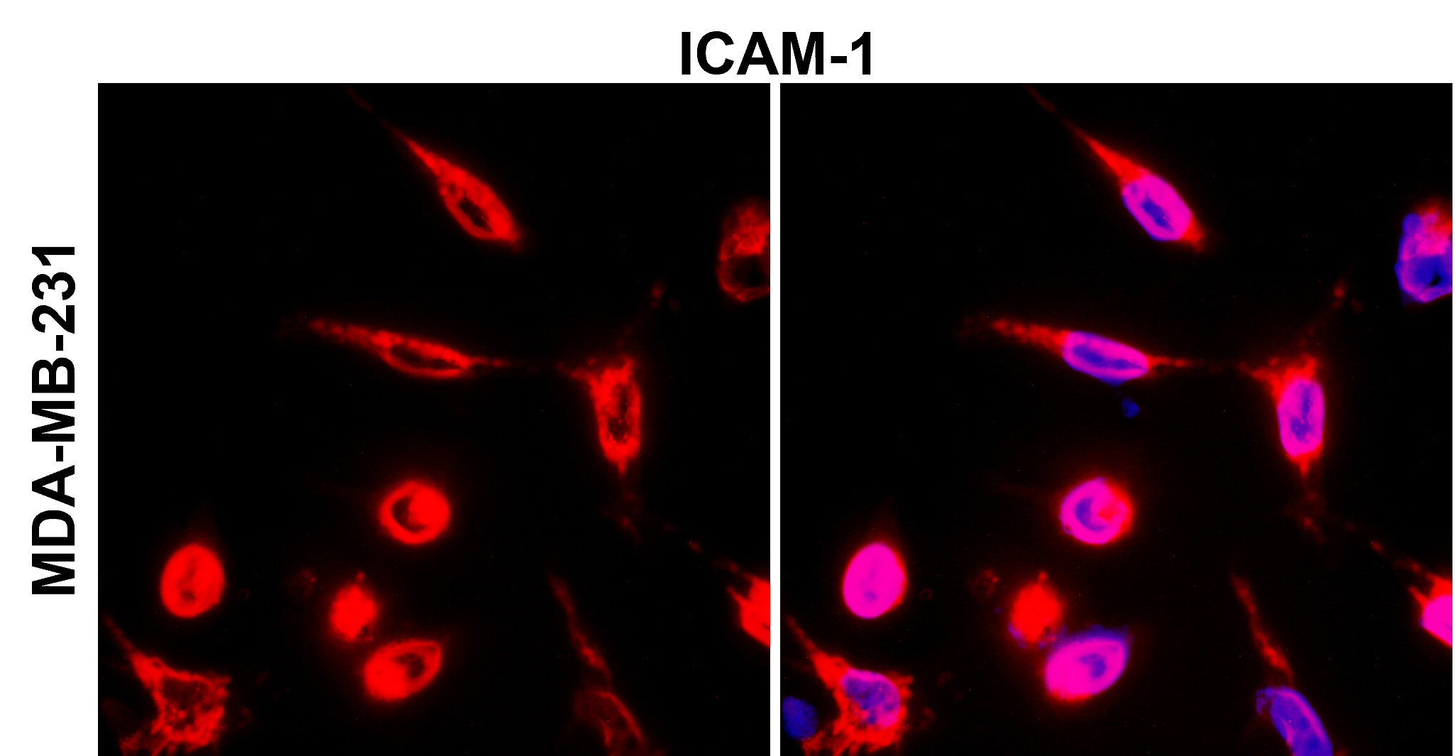 IR78-268 anti-ICAM-1 / CD54 antibody_MDA-MB-231 ICC/IF image