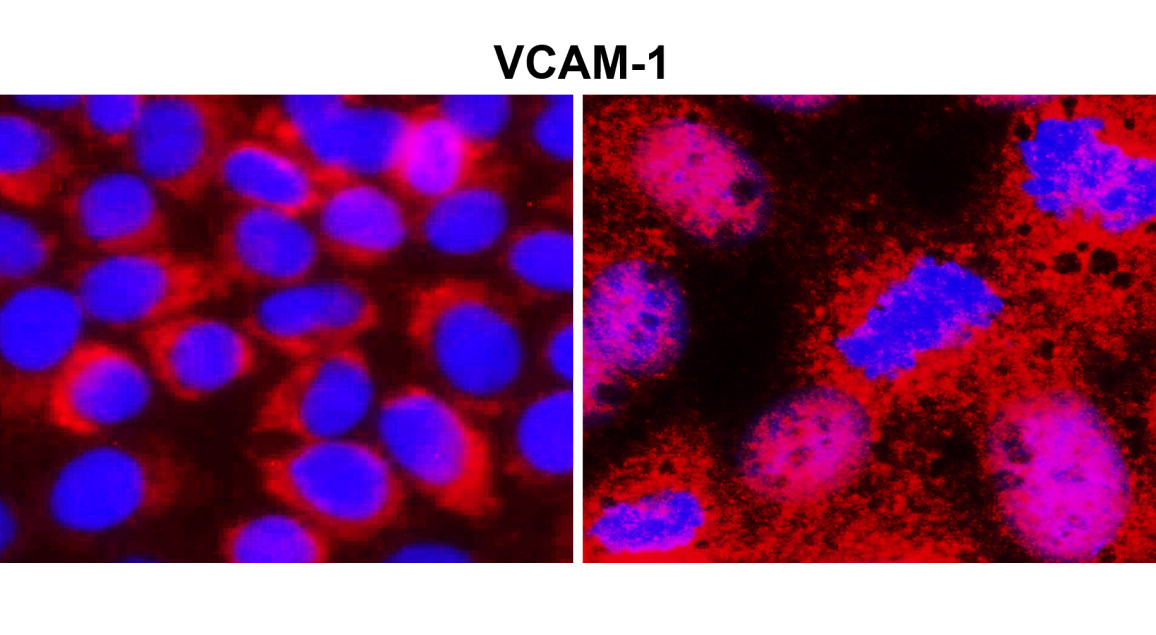 IR79-272 anti-VCAM-1 / CD106 antibody ICC/IF image