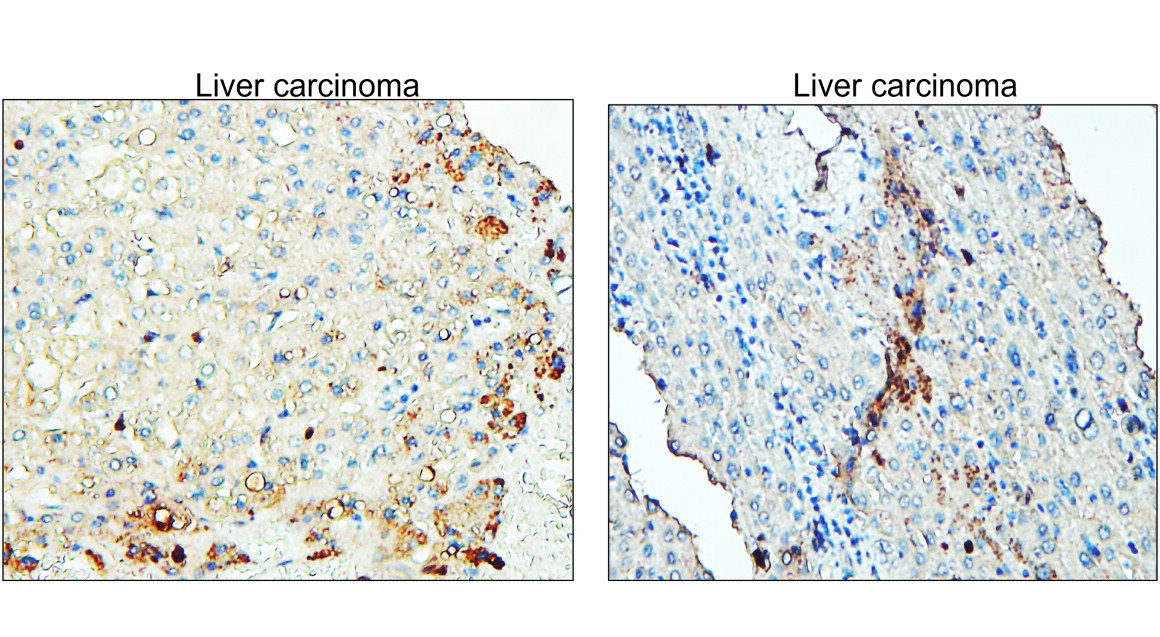 IR297-2 anti-ST3GAL1 antibody IHC image