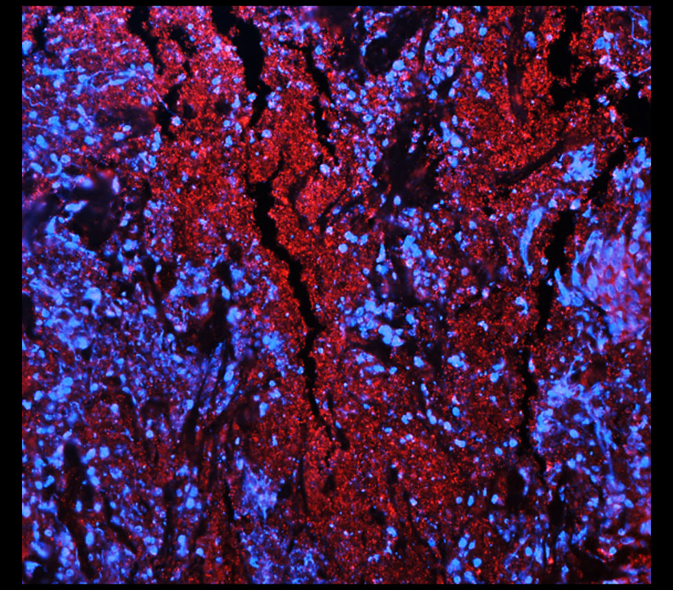 IR297-2 anti-ST3GAL1 antibody IF image