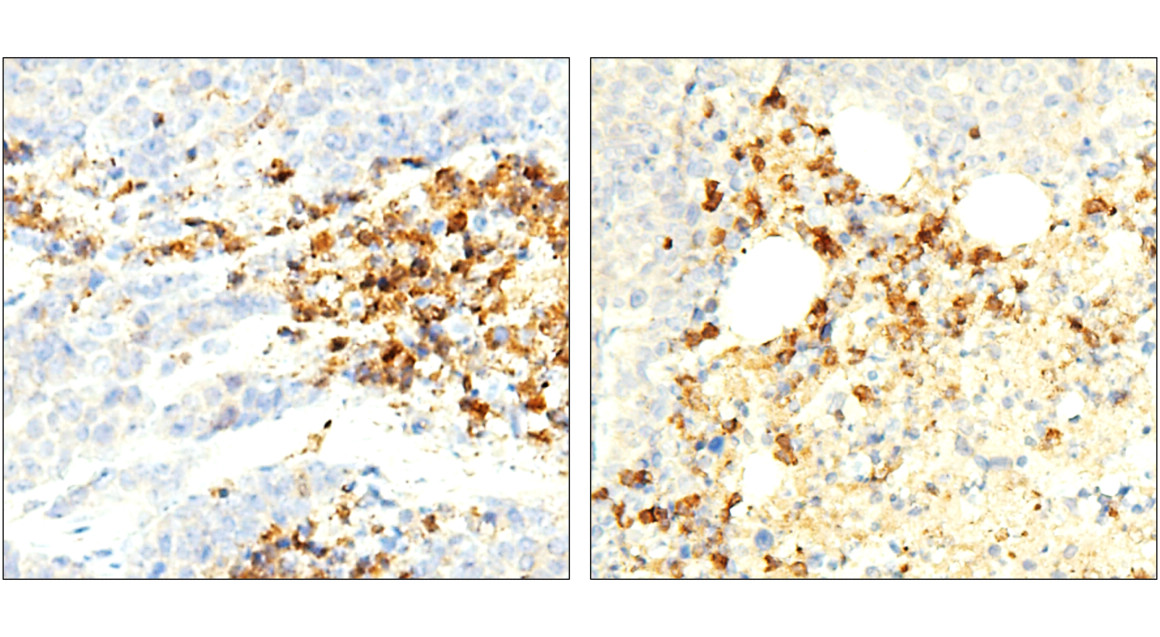 Customer feedback IR297-2 anti-ST3GAL1 antibody IHC image