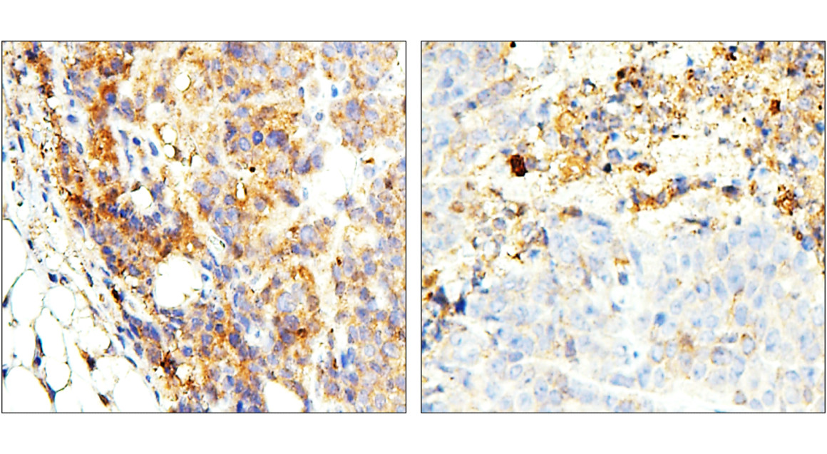 Customer feedback IR297-2 anti-ST3GAL1 antibody IHC image