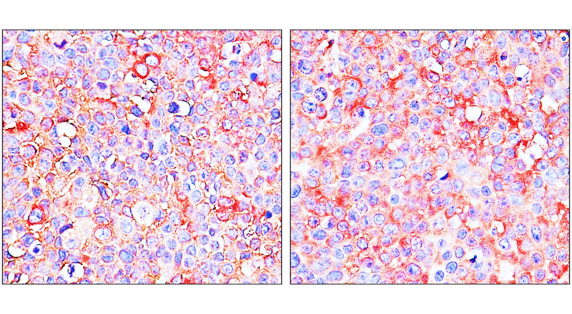 Customer feedback IR297-2 anti-ST3GAL1 antibody IHC image