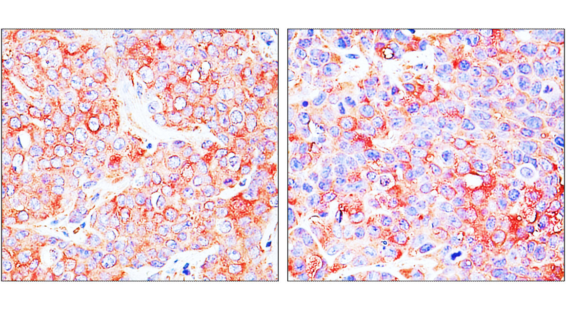 Customer feedback IR297-2 anti-ST3GAL1 antibody IHC image