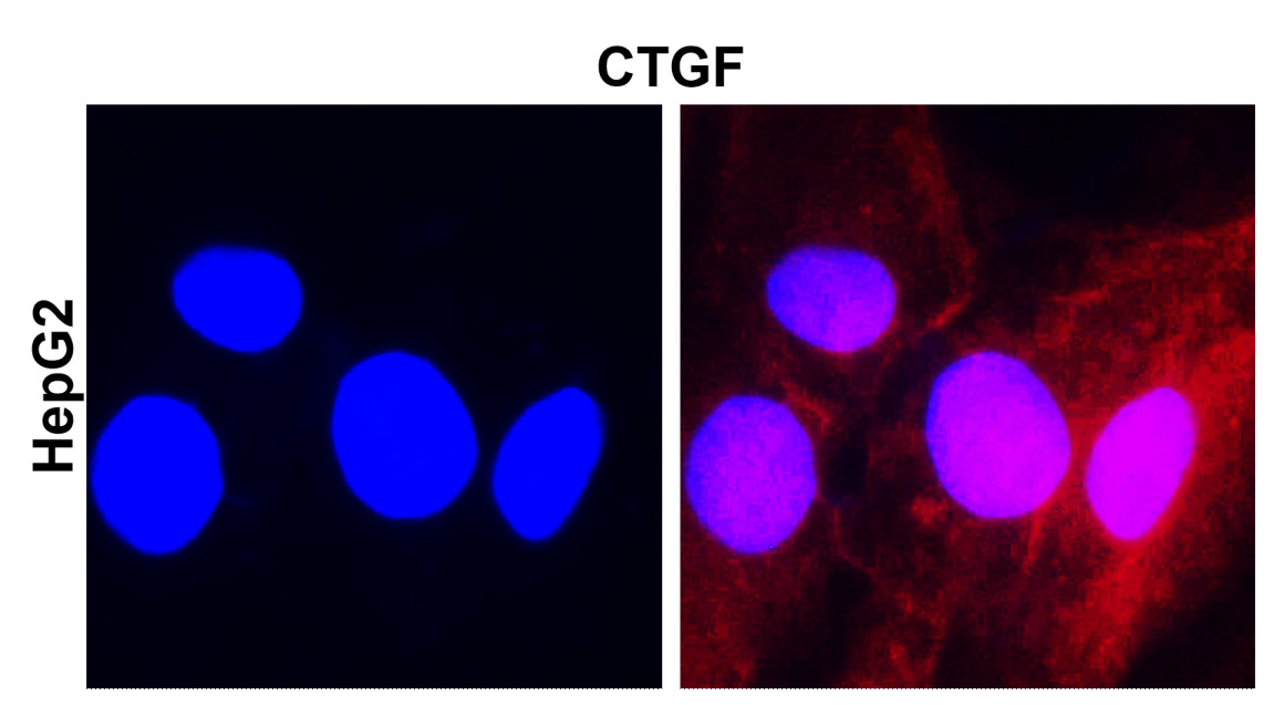 IR289-955 anti-CTGF antibody ICC/IF image