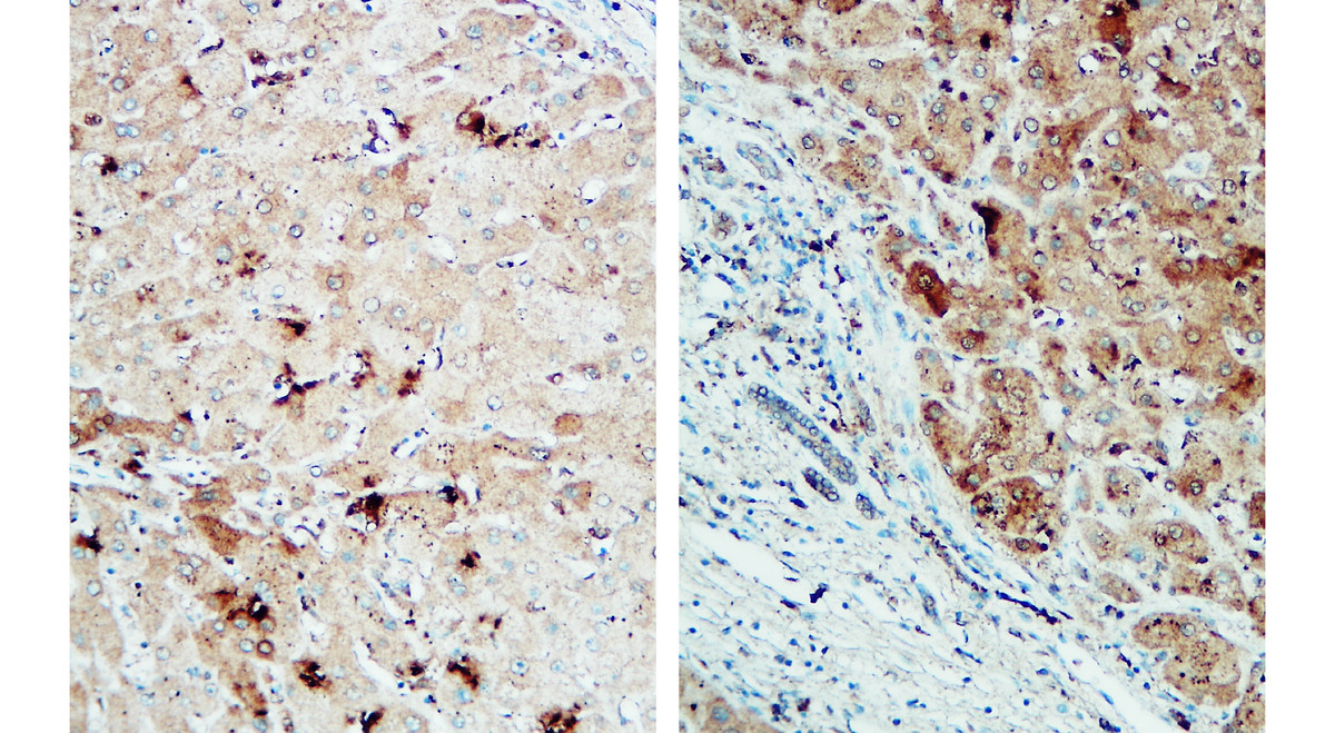 IR92-388 anti-NLRP3 antibody  IHC image