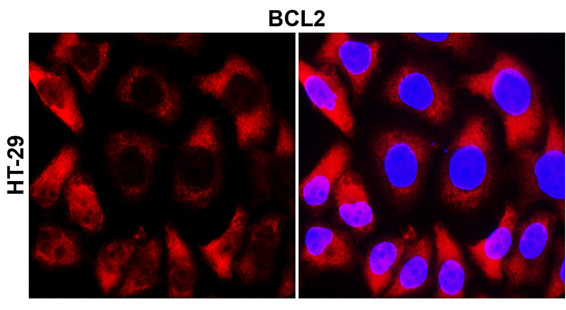 IR94-392 anti-BCL2 antibody  ICC/IF image 