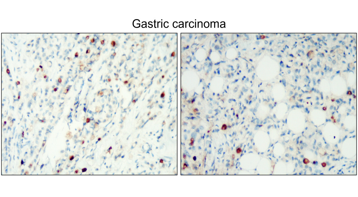 IR239-896 anti- CD138 / Syndecan-1 antibody IHC image