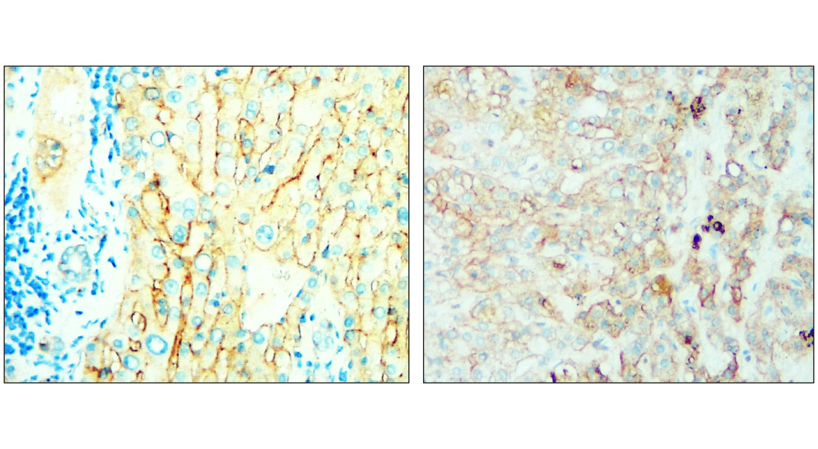 IR239-895 anti- Syndecan-1 / CD138 antibody IHC image