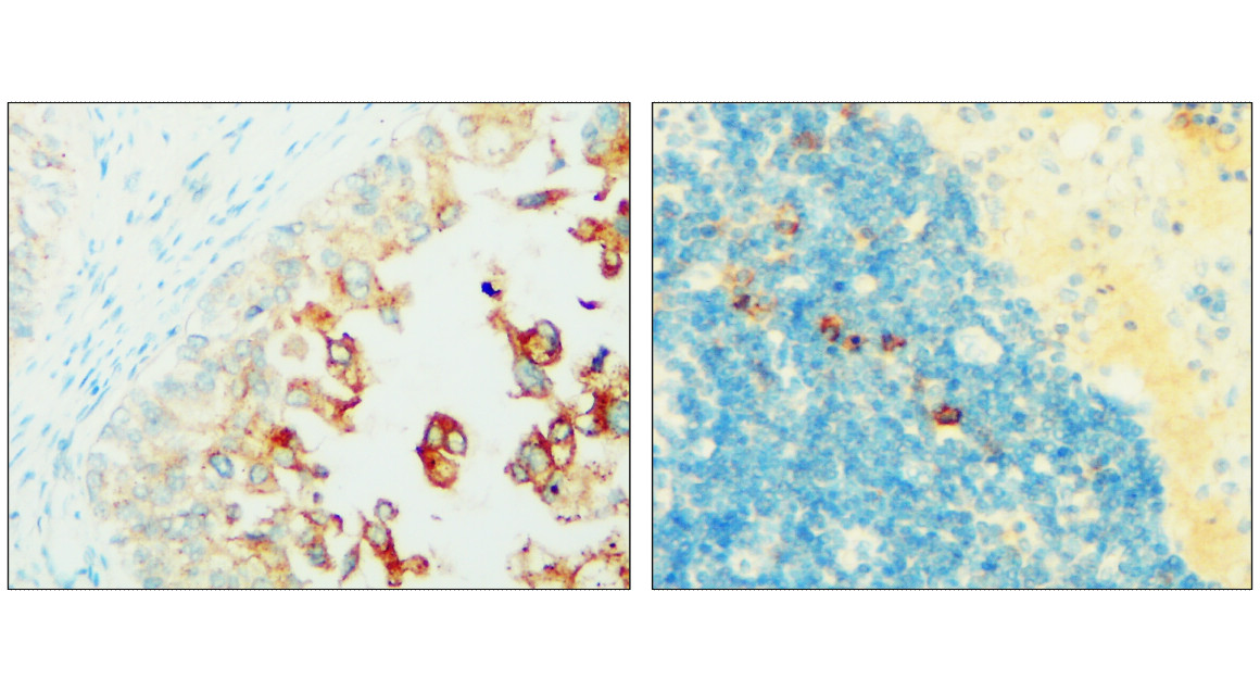 IR239-895 anti- Syndecan-1 / CD138 antibody IHC image