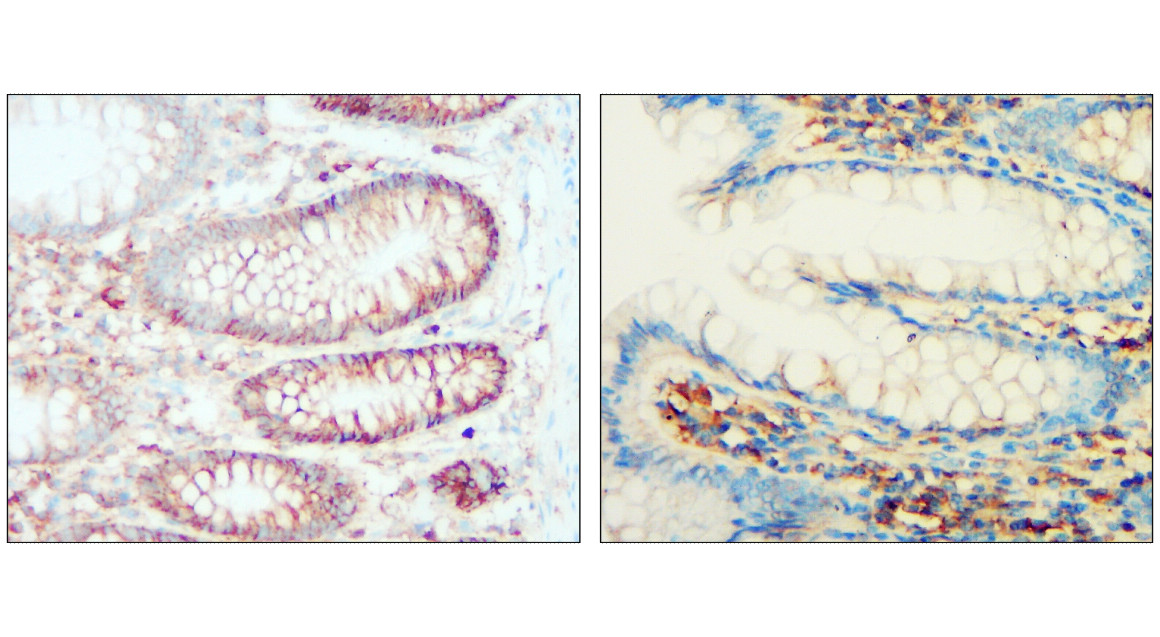 IR239-895 anti- Syndecan-1 / CD138 antibody IHC image