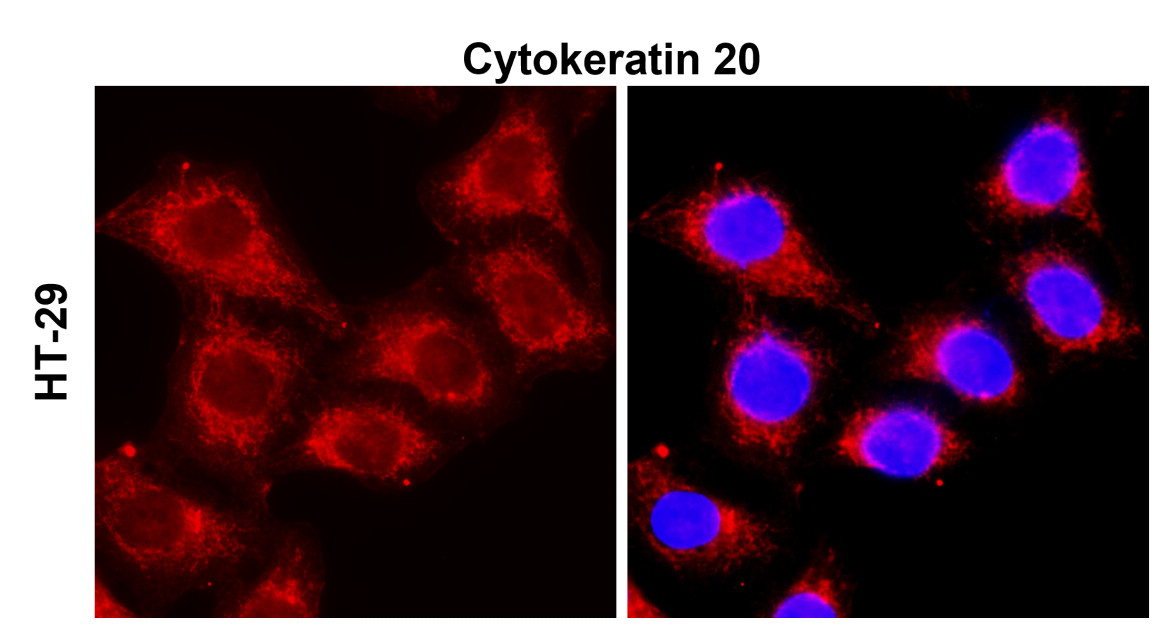 IR238-892 anti-Cytokeratin 20 antibody ICC/IF image