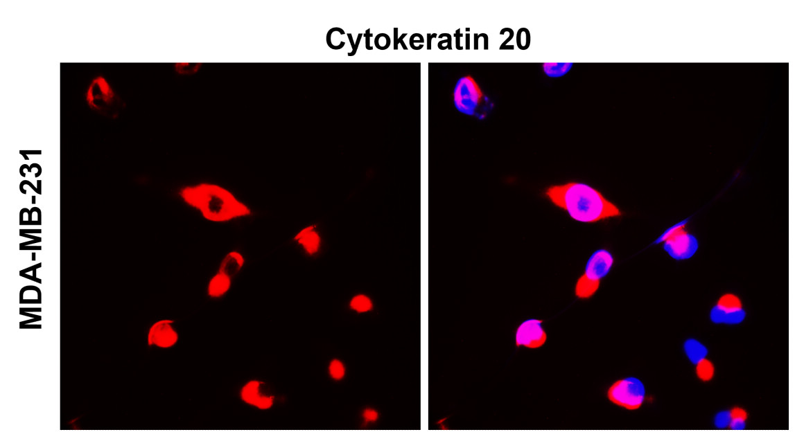 IR238-892 anti-Cytokeratin 20 antibody ICC/IF image