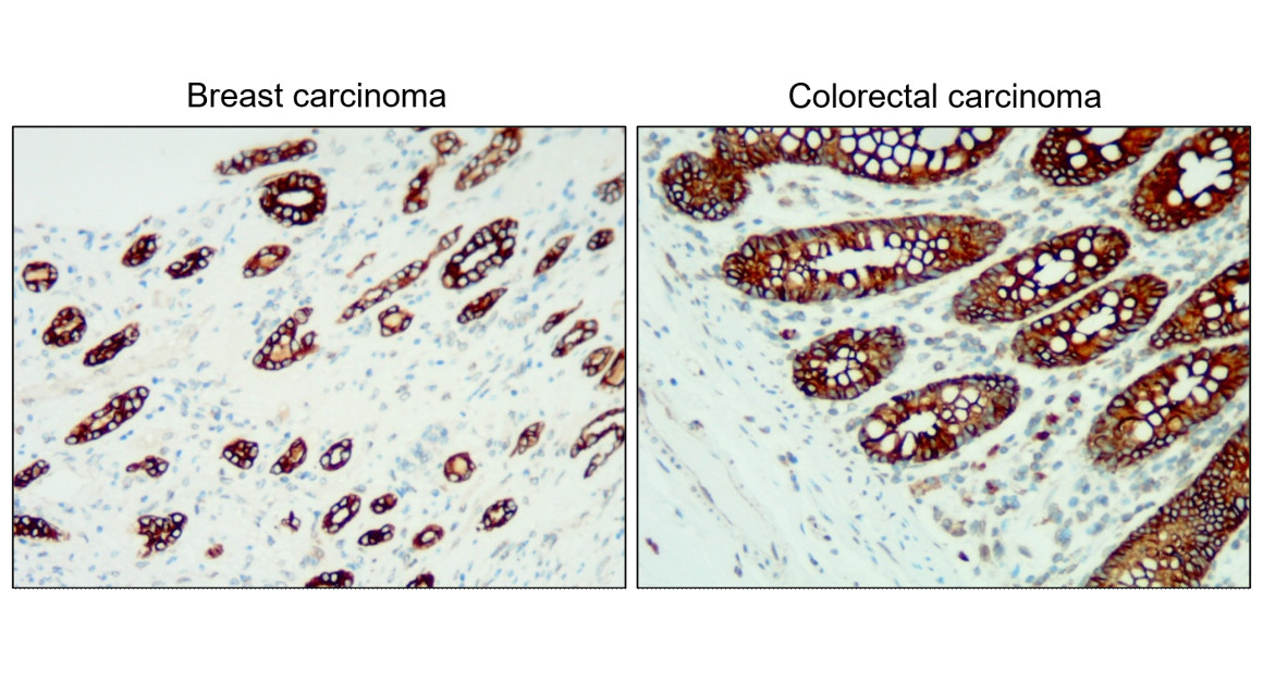 IR236-890 anti-Cytokeratin 18/19 antibody IHC image