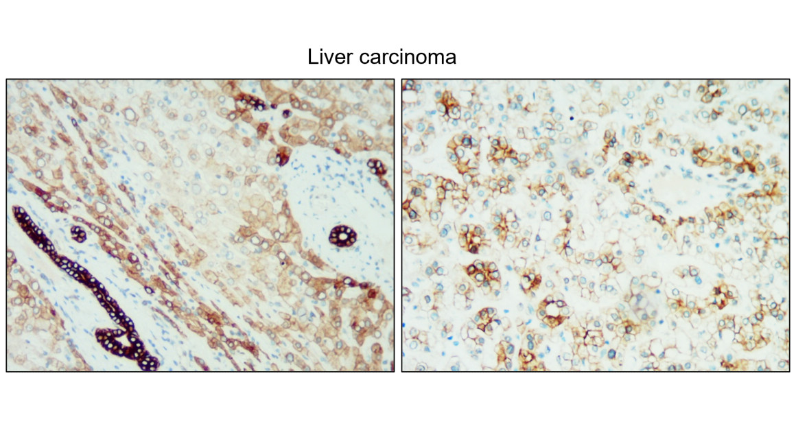 IR236-890 anti-Cytokeratin 18/19 antibody IHC image